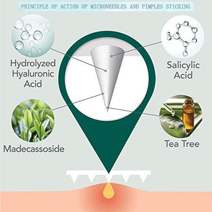 Microneedle Acne Healing Patches (9 Pack)
