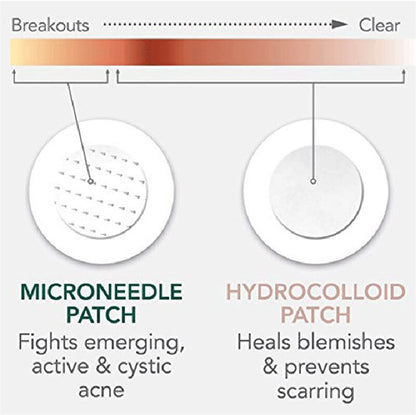 Microneedle Acne Healing Patches (9 Pack)