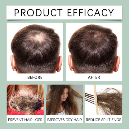 Original Rosemary Hair Spray, Rosemary Dense Hair Nourishing Scalp Massage Jet Black Growth Spray