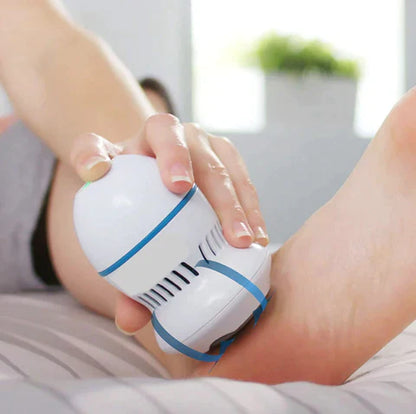Iridescent Glow™ Vacuum Callus Remover