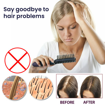 OUHOE Hair Treatment Spray Strengthens Hair, Moisturizes Hair, Improves Dry And Irritated Hair And Hydrates Hair Treatment Spray